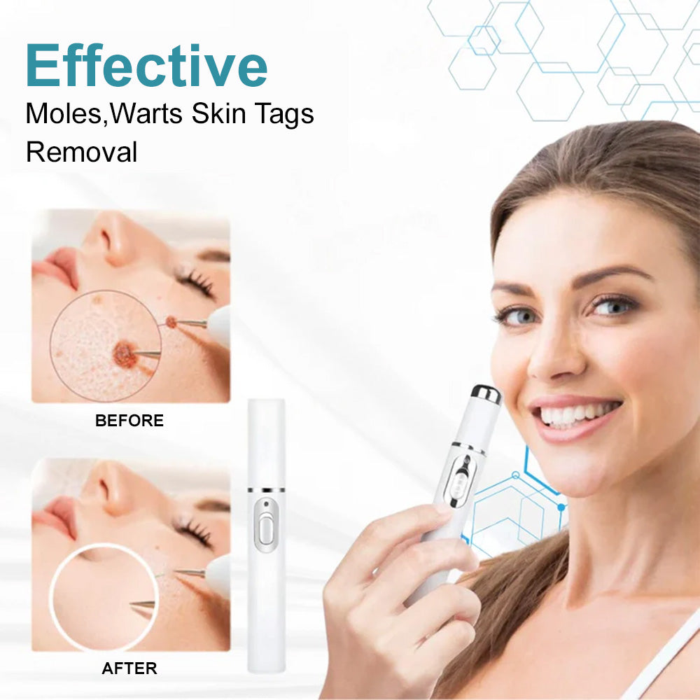 👨⚕️Bikenda® Medical-Grade Wart Removal Laser Pen