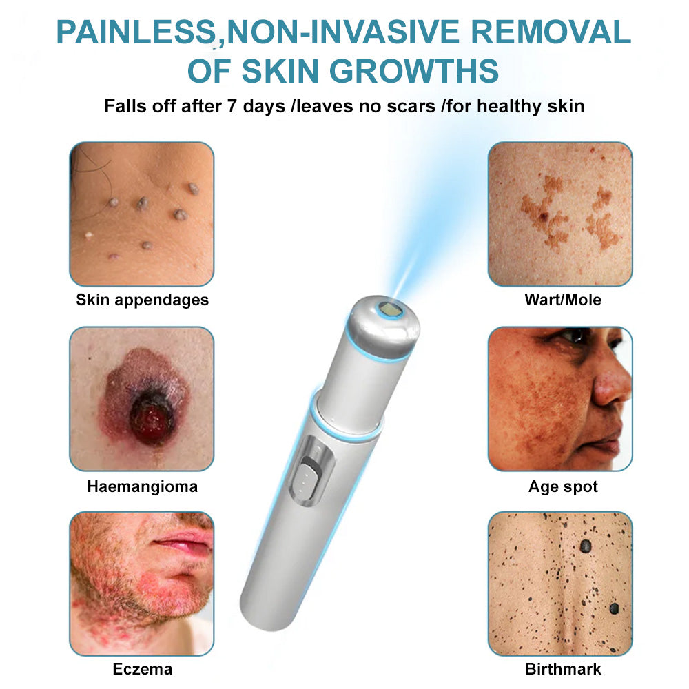 👨⚕️Bikenda® Medical-Grade Wart Removal Laser Pen