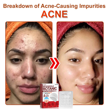 ✅𝐆𝐅𝐎𝐔𝐊® 𝐌𝐢𝐜𝐫𝐨𝐍𝐞𝐞𝐝𝐥𝐞 𝐁𝐨𝐭𝐚𝐧𝐢𝐜 𝐒𝐤𝐢𝐧 𝐓𝐚𝐠 𝐑𝐞𝐦𝐨𝐯𝐚𝐥 𝐏𝐚𝐭𝐜𝐡 –  𝐕𝐢𝐬𝐢𝐛𝐥𝐞 𝐑𝐞𝐬𝐮𝐥𝐭𝐬 𝐢𝐧 𝐉𝐮𝐬𝐭 𝟓 𝐃𝐚𝐲𝐬