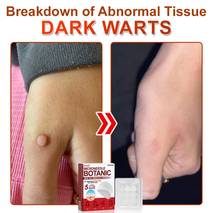 ✅𝐆𝐅𝐎𝐔𝐊® 𝐌𝐢𝐜𝐫𝐨𝐍𝐞𝐞𝐝𝐥𝐞 𝐁𝐨𝐭𝐚𝐧𝐢𝐜 𝐒𝐤𝐢𝐧 𝐓𝐚𝐠 𝐑𝐞𝐦𝐨𝐯𝐚𝐥 𝐏𝐚𝐭𝐜𝐡 –  𝐕𝐢𝐬𝐢𝐛𝐥𝐞 𝐑𝐞𝐬𝐮𝐥𝐭𝐬 𝐢𝐧 𝐉𝐮𝐬𝐭 𝟓 𝐃𝐚𝐲𝐬