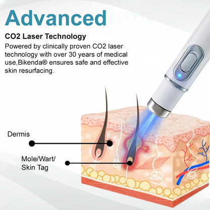 👨‍⚕️Bikenda® Medical-Grade Wart Removal Laser Pen – Non-Invasive & Scar-Free | Dermatologist Approved