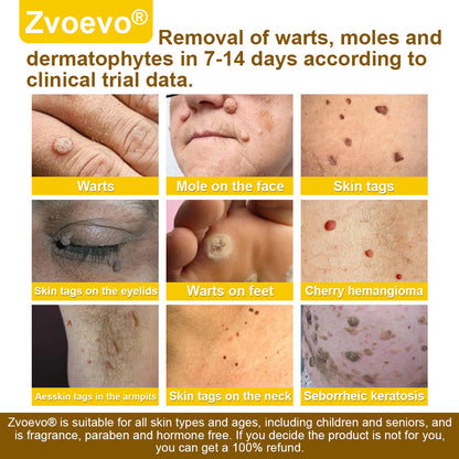 🐝𝐳𝐯𝐨𝐞𝐯𝐨® 𝐁𝐞𝐞 𝐕𝐞𝐧𝐨𝐦 𝐒𝐤𝐢𝐧 𝐒𝐩𝐫𝐚𝐲