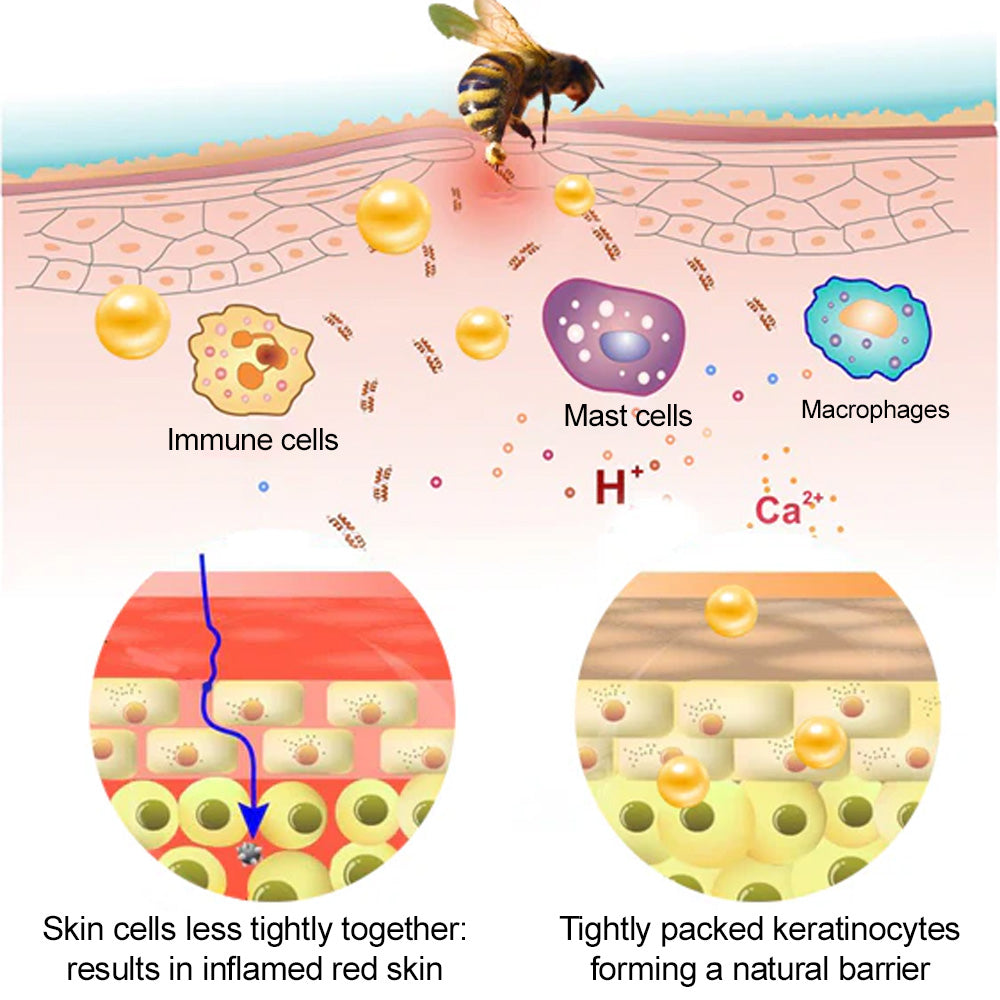 🐝𝐳𝐯𝐨𝐞𝐯𝐨® 𝐁𝐞𝐞 𝐕𝐞𝐧𝐨𝐦 𝐒𝐤𝐢𝐧 𝐒𝐩𝐫𝐚𝐲
