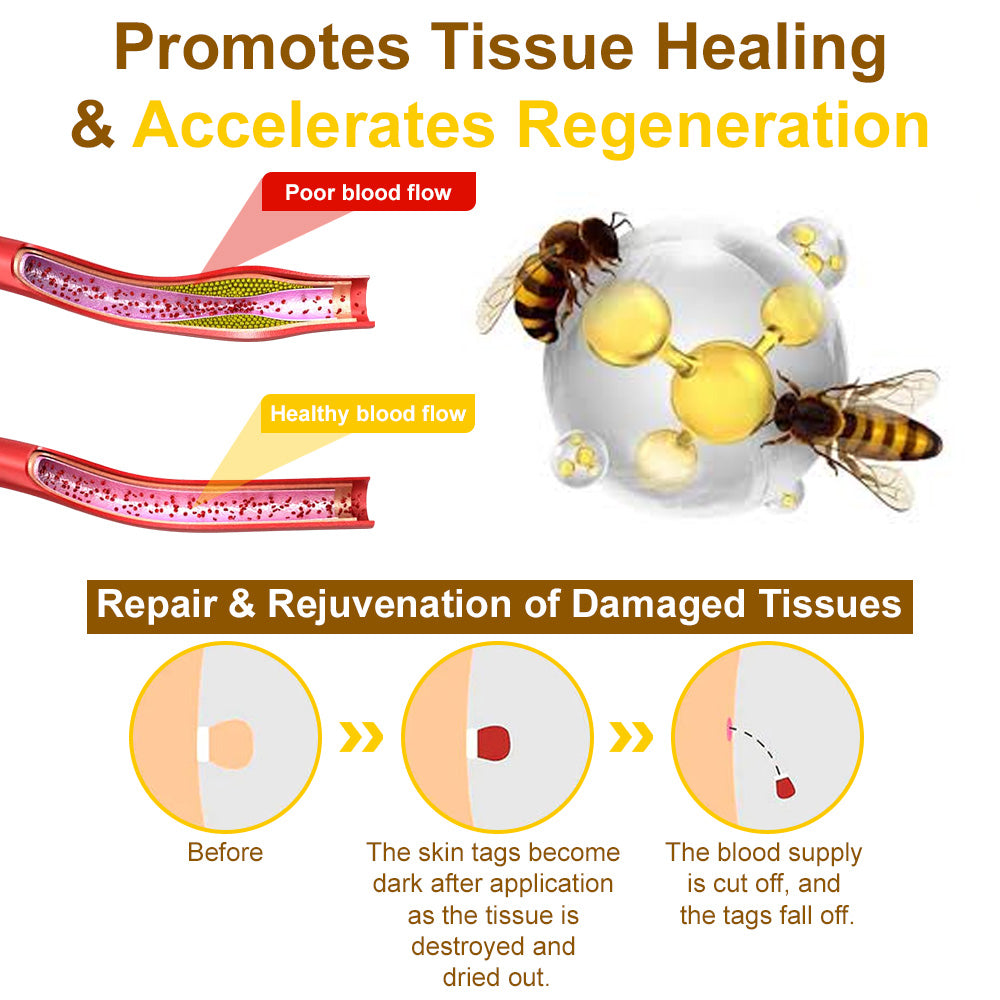 🐝𝐳𝐯𝐨𝐞𝐯𝐨® 𝐁𝐞𝐞 𝐕𝐞𝐧𝐨𝐦 𝐒𝐤𝐢𝐧 𝐒𝐩𝐫𝐚𝐲