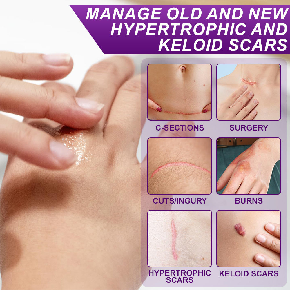 💙MHRA-CERTIFIED✅flysmus® cure FACE & BODY SCAR GEL – Clinically proven to soften, flatten and fade surgical scars, acne marks, burns, keloids and trauma-related scars.