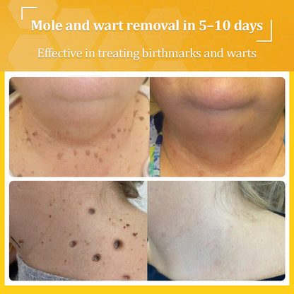 ✅𝐟𝐥𝐲𝐬𝐦𝐮𝐬® 𝐁𝐞𝐞 𝐕𝐞𝐧𝐨𝐦 𝐀𝐥𝐥-𝐢𝐧-𝐎𝐧𝐞 𝐂𝐫𝐞𝐚𝐦 – Provides effective relief for stubborn warts, skin bumps, lesions, infections, and scars.