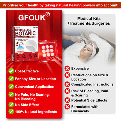 ✅𝐆𝐅𝐎𝐔𝐊® 𝐌𝐢𝐜𝐫𝐨𝐍𝐞𝐞𝐝𝐥𝐞 𝐁𝐨𝐭𝐚𝐧𝐢𝐜 𝐒𝐤𝐢𝐧 𝐓𝐚𝐠 𝐑𝐞𝐦𝐨𝐯𝐚𝐥 𝐏𝐚𝐭𝐜𝐡 –  𝐕𝐢𝐬𝐢𝐛𝐥𝐞 𝐑𝐞𝐬𝐮𝐥𝐭𝐬 𝐢𝐧 𝐉𝐮𝐬𝐭 𝟓 𝐃𝐚𝐲𝐬
