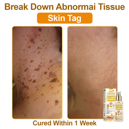 🐝𝐳𝐯𝐨𝐞𝐯𝐨® 𝐁𝐞𝐞 𝐕𝐞𝐧𝐨𝐦 𝐒𝐤𝐢𝐧 𝐒𝐩𝐫𝐚𝐲