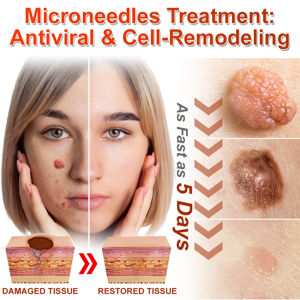 ✅𝐆𝐅𝐎𝐔𝐊® 𝐌𝐢𝐜𝐫𝐨𝐍𝐞𝐞𝐝𝐥𝐞 𝐁𝐨𝐭𝐚𝐧𝐢𝐜 𝐒𝐤𝐢𝐧 𝐓𝐚𝐠 𝐑𝐞𝐦𝐨𝐯𝐚𝐥 𝐏𝐚𝐭𝐜𝐡 –  𝐕𝐢𝐬𝐢𝐛𝐥𝐞 𝐑𝐞𝐬𝐮𝐥𝐭𝐬 𝐢𝐧 𝐉𝐮𝐬𝐭 𝟓 𝐃𝐚𝐲𝐬