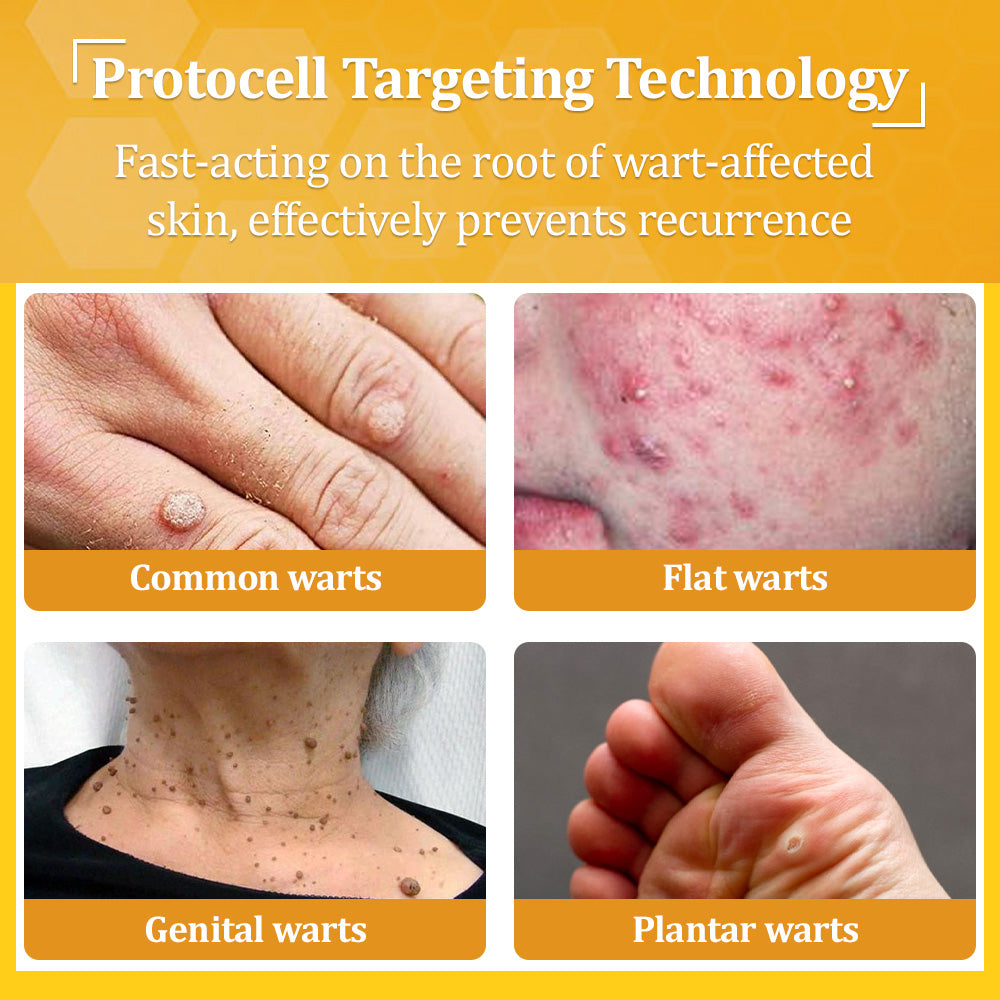 ✅𝐟𝐥𝐲𝐬𝐦𝐮𝐬® 𝐁𝐞𝐞 𝐕𝐞𝐧𝐨𝐦 𝐀𝐥𝐥-𝐢𝐧-𝐎𝐧𝐞 𝐂𝐫𝐞𝐚𝐦 – Provides effective relief for stubborn warts, skin bumps, lesions, infections, and scars.