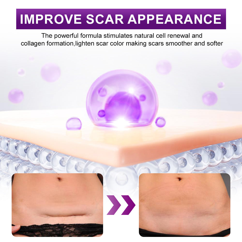 💙MHRA-CERTIFIED✅flysmus® cure FACE & BODY SCAR GEL – Clinically proven to soften, flatten and fade surgical scars, acne marks, burns, keloids and trauma-related scars.
