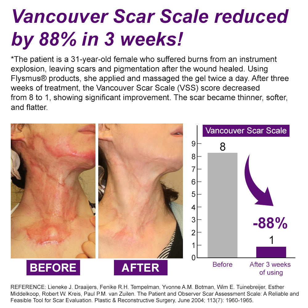 💙MHRA-CERTIFIED✅flysmus® cure FACE & BODY SCAR GEL – Clinically proven to soften, flatten and fade surgical scars, acne marks, burns, keloids and trauma-related scars.