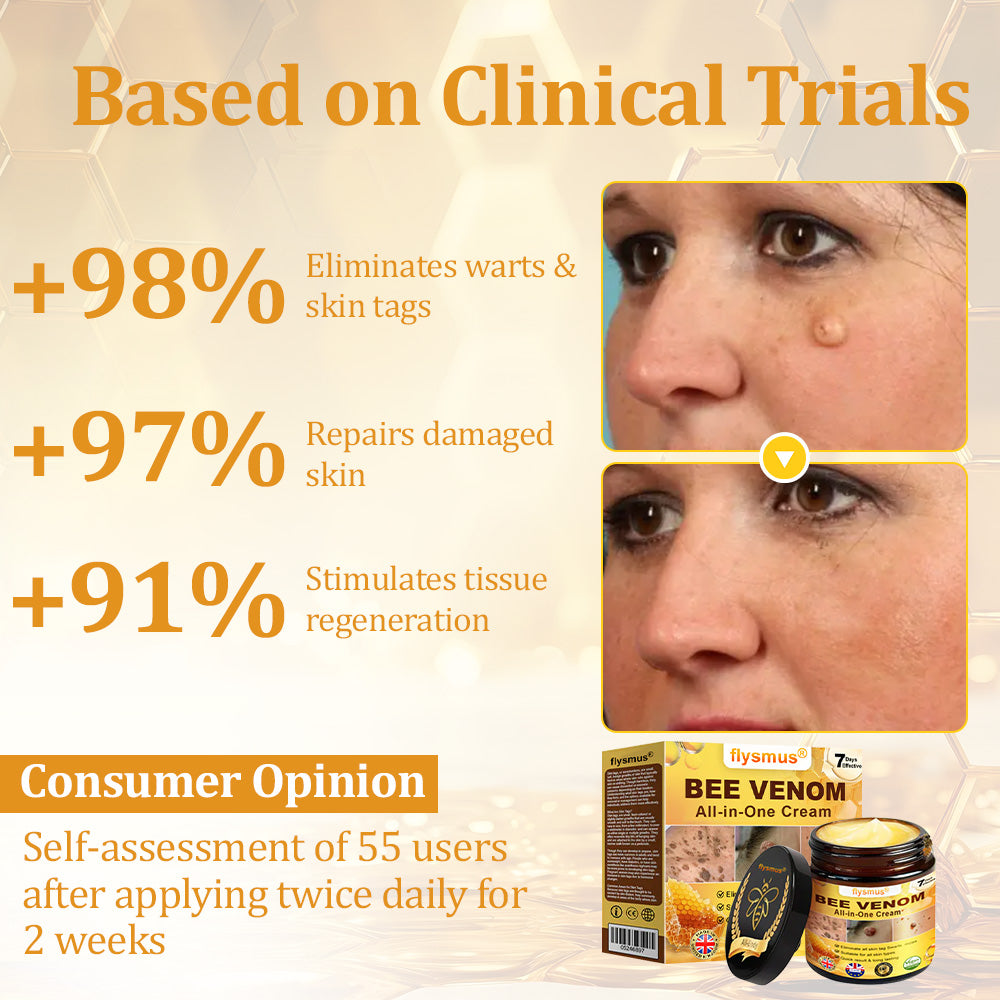 ✅𝐟𝐥𝐲𝐬𝐦𝐮𝐬® 𝐁𝐞𝐞 𝐕𝐞𝐧𝐨𝐦 𝐀𝐥𝐥-𝐢𝐧-𝐎𝐧𝐞 𝐂𝐫𝐞𝐚𝐦 – Provides effective relief for stubborn warts, skin bumps, lesions, infections, and scars.