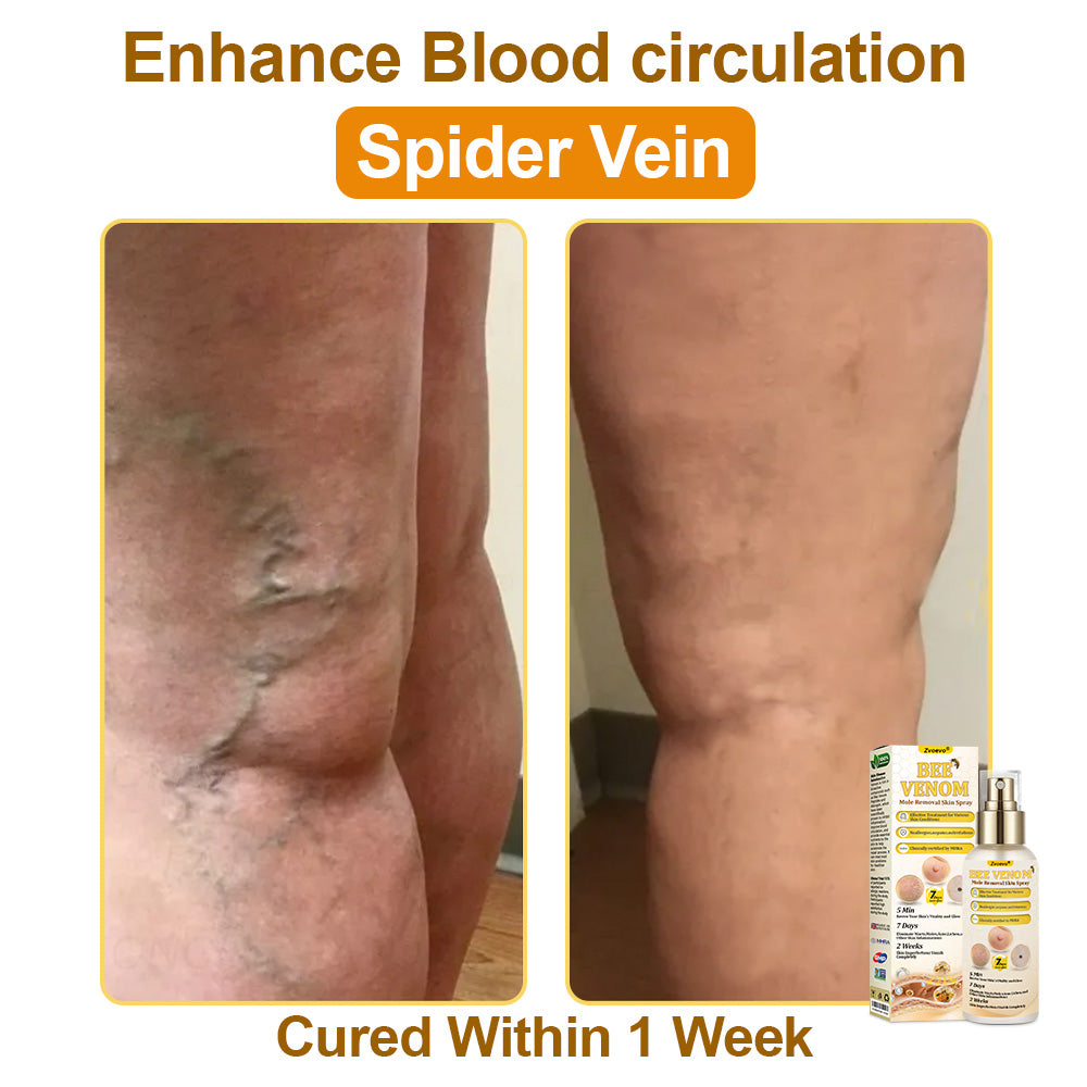 🐝𝐳𝐯𝐨𝐞𝐯𝐨® 𝐁𝐞𝐞 𝐕𝐞𝐧𝐨𝐦 𝐒𝐤𝐢𝐧 𝐒𝐩𝐫𝐚𝐲