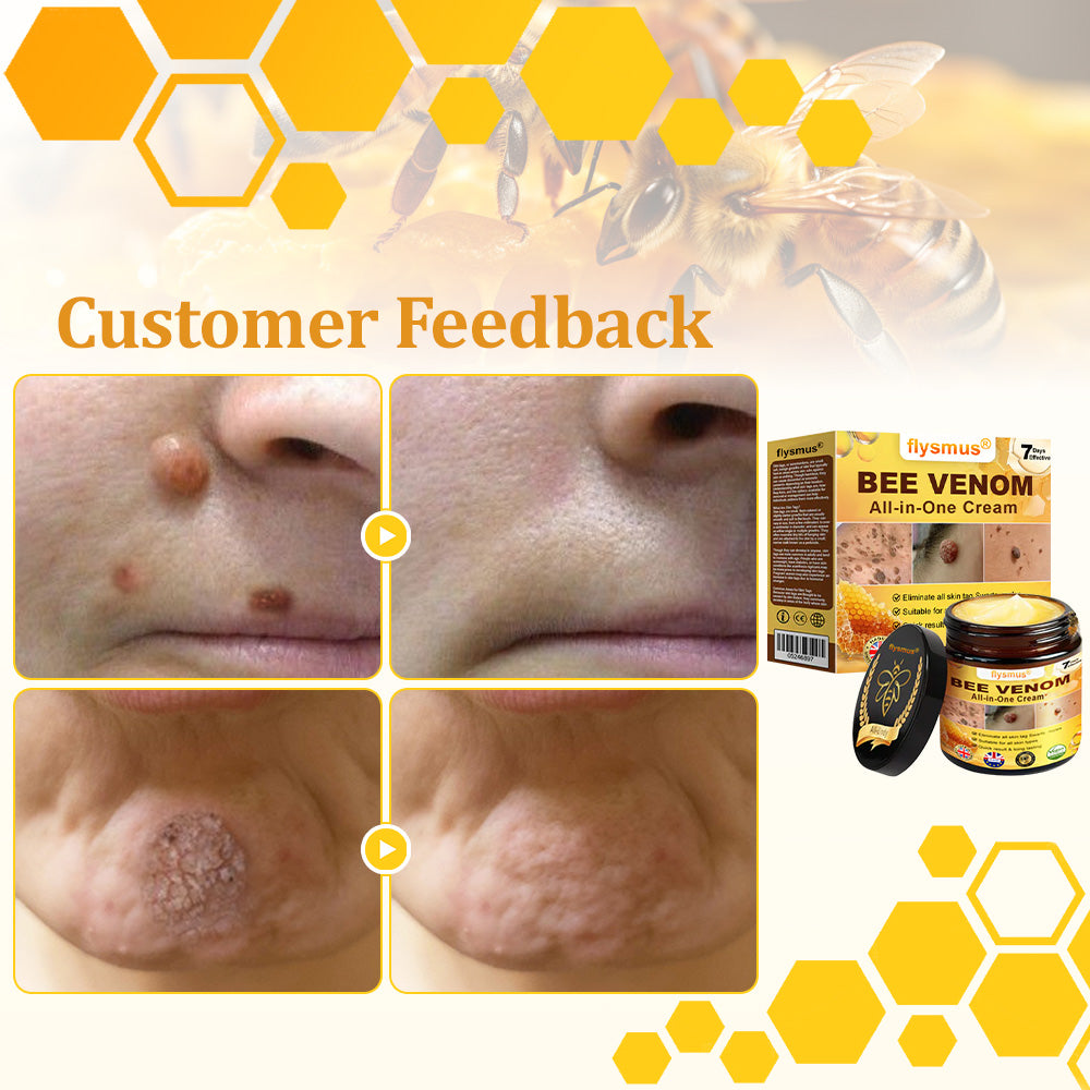 ✅𝐟𝐥𝐲𝐬𝐦𝐮𝐬® 𝐁𝐞𝐞 𝐕𝐞𝐧𝐨𝐦 𝐀𝐥𝐥-𝐢𝐧-𝐎𝐧𝐞 𝐂𝐫𝐞𝐚𝐦 – Provides effective relief for stubborn warts, skin bumps, lesions, infections, and scars.