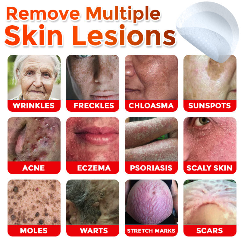 🔥𝐆𝐅𝐎𝐔𝐊® 𝐌𝐢𝐜𝐫𝐨𝐍𝐞𝐞𝐝𝐥𝐞 𝐁𝐨𝐭𝐚𝐧𝐢𝐜 𝐒𝐤𝐢𝐧 𝐓𝐚𝐠 𝐑𝐞𝐦𝐨𝐯𝐚𝐥 𝐏𝐚𝐭𝐜𝐡 – 𝐕𝐢𝐬𝐢𝐛𝐥𝐞 𝐑𝐞𝐬𝐮𝐥𝐭𝐬 𝐢𝐧 𝐉𝐮𝐬𝐭 𝟓 𝐃𝐚𝐲𝐬